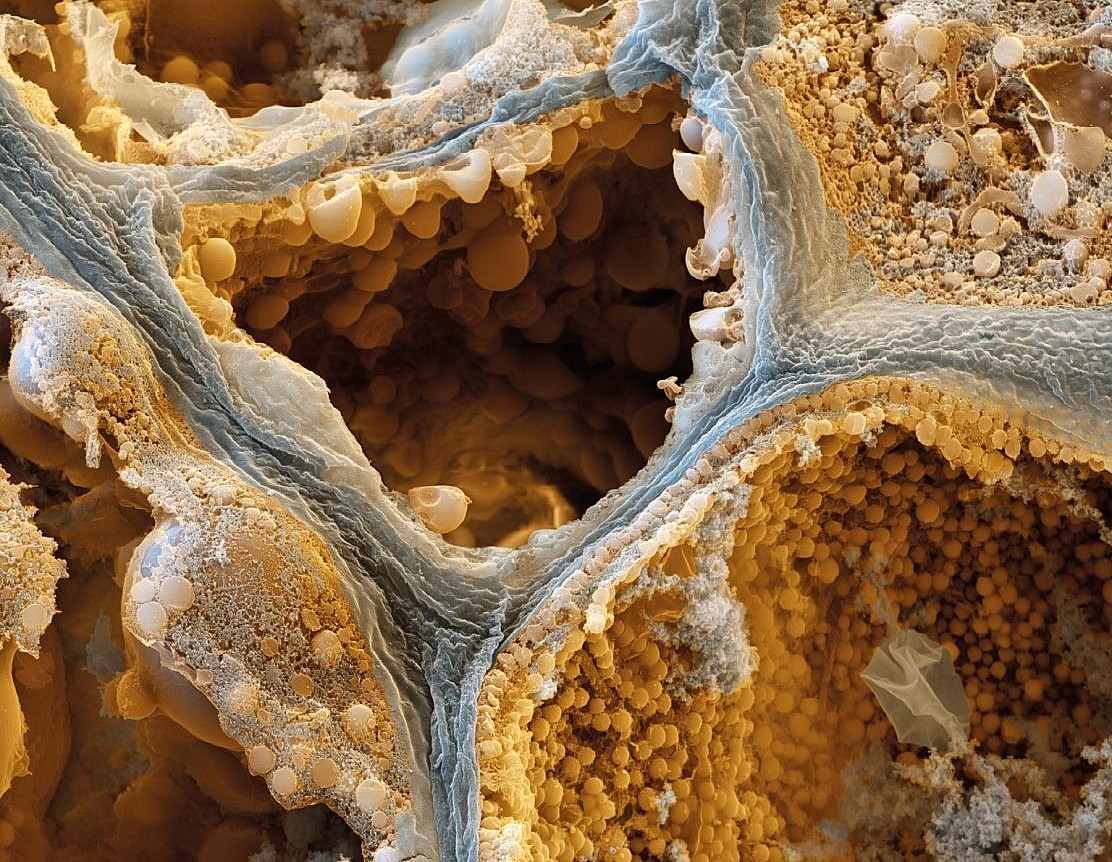 kávová buňka okem elektronového mikroskopu